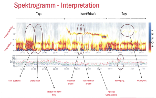 Herzratenvariablität Spektogramm - Interpretation